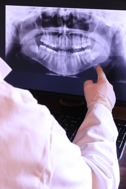 Best Teeth Whitening  in Marshallville, GA