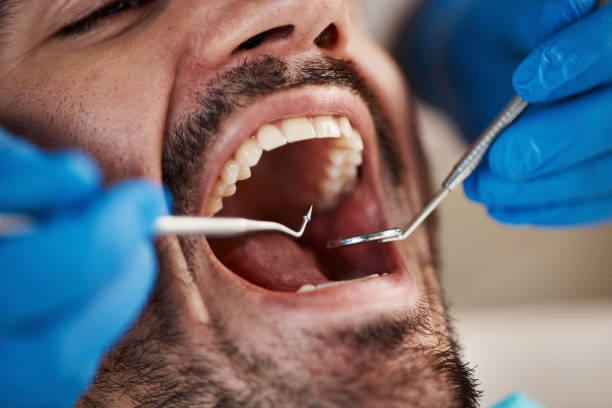 Best Urgent Tooth Repair  in Marshallville, GA