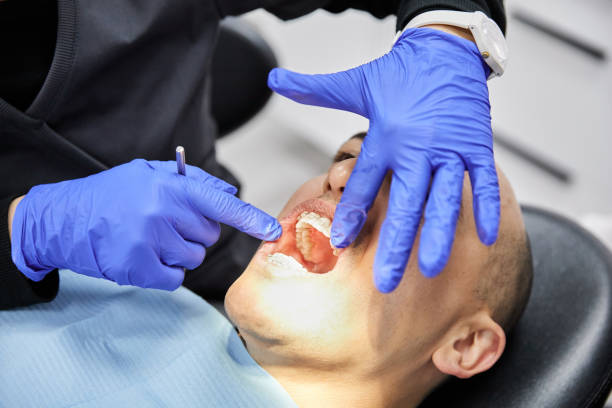 Best Root Canal Emergency Dentist  in Marshallville, GA